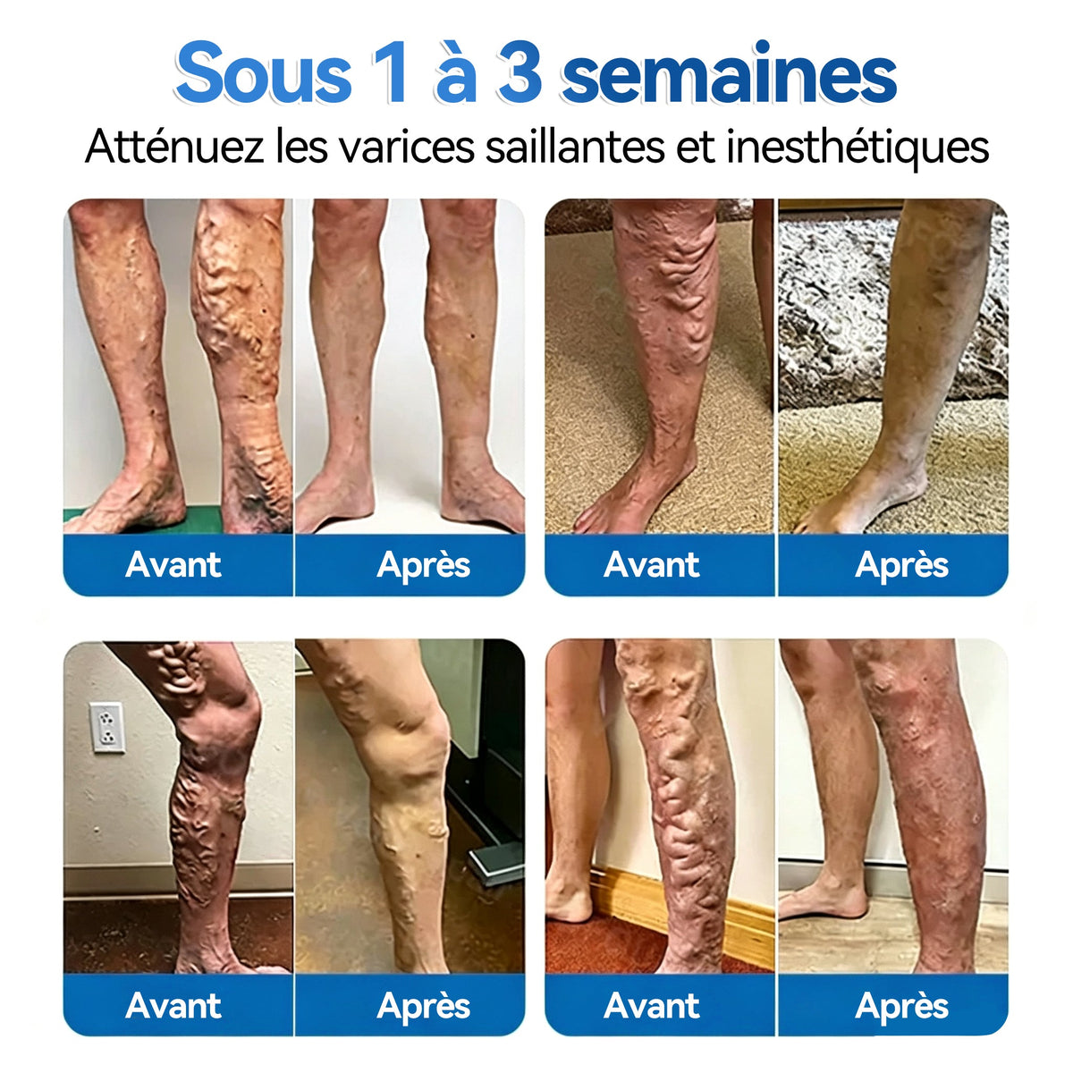 🌼💖𝐅𝐥𝐨𝐫𝐢𝐬𝐦𝐚®𝐑é𝐩𝐚𝐫𝐚𝐭𝐢𝐨𝐧 𝐃𝐞𝐬 𝐕𝐞𝐢𝐧𝐞𝐬 𝐑𝐨𝐮𝐥𝐞𝐚𝐮 𝐃𝐞 𝐏𝐚𝐭𝐜𝐡𝐬 𝐀𝐯𝐞𝐜 𝐌𝐢𝐜𝐫𝐨-𝐚𝐢𝐠𝐮𝐢𝐥𝐥𝐞𝐬⚡Soulagement immédiat, résultats à long terme