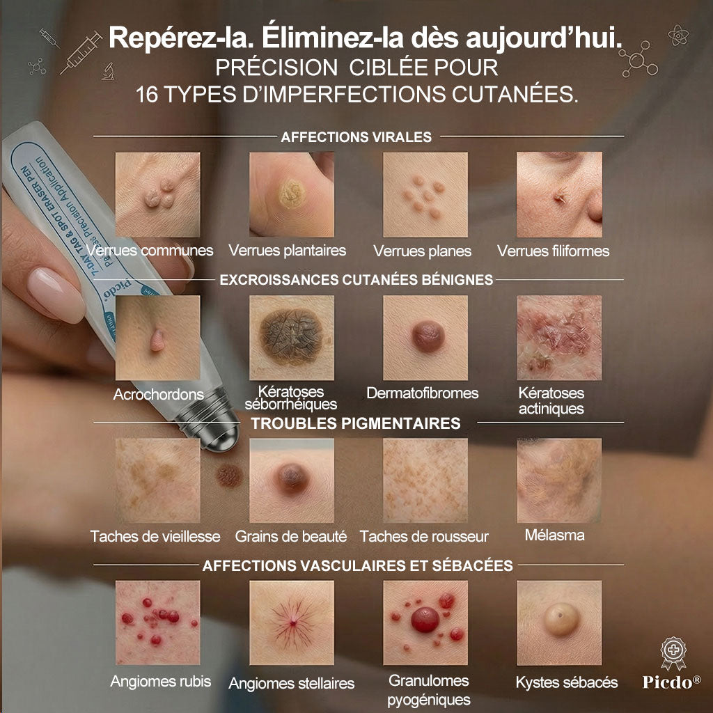 Boutique officielle de la marque 𝐏i𝐜𝐝o® 🍉💖7 Jours Effaceur de taches et d’excroissances cutanées(Zéro douleur, zéro cicatrice – Roller)