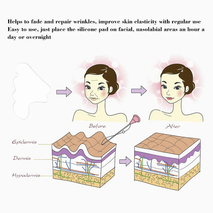 Facial Wrinkle Remover Pad Reusable Medical Grade Silicone Nasolabial Folds Anti-aging Mask Prevent Wrinkle Skin Lifting Patches